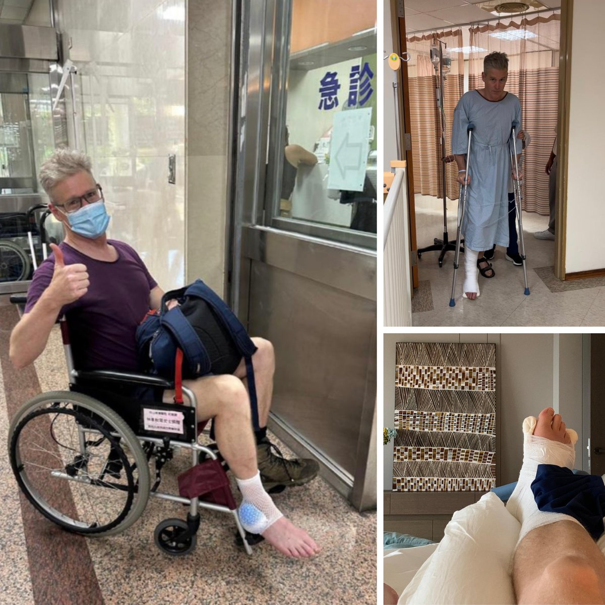 AusOfficeTPE's tweet photo. I love #hiking in Taiwan but you need to be careful. Many thanks to the wonderful medical teams at Chung-Shan hospital and Taipei Adventist Hospital for looking after my broken ankle. I now have an even stronger desire to strengthen Australia and Taiwan’s health cooperation. 😄 https://t.co/n7H6qASSBB