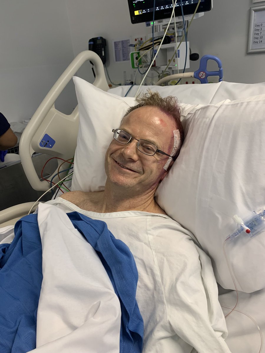 ProfRAScolyer's tweet photo. I’m proud of being able to use my illness to push boundaries to obtain new scientific knowledge re the brain cancer #glioblastoma. Today is a special #anniversary day for me. 

Instead of a stereotactic core biopsy for initial confirmatory diagnosis of my glioblastoma, one year, one month & one day ago today, I had a riskier open #craniotomy surgical procedure. This was performed to obtain more tumour tissue before I received a combination of different types of #immunotherapy drugs neoadjuvantly (ie before debulking surgery which occurred 16 days later). This facilitated subsequent more in depth scientific #research to be conducted comparing my #brain tumour before (pre) & after (post) I had received #neoadjuvant combination immunotherapy. 

The research, which has been submitted for publication and is undergoing external peer review, excitingly showed data that immunotherapy was having an effect on the number & type of immune cells within my tumour. But ultimately a #clinical #trial needs to be performed to determine whether such changes with neoadjuvant combination immunotherapy translate into better clinical outcomes for glioblastoma patients.

A #cancer journey is incredibly difficult for patients and their families and just as I continue to rely on my neuro-oncology clinical team for their expert guidance, I strongly encourage all brain cancer patients to continue consulting their own medical teams. 

@NthSydHealth 
@SydneyLHD 
@Sydney_Uni 
@Dr_Brindha 
@whittlejim