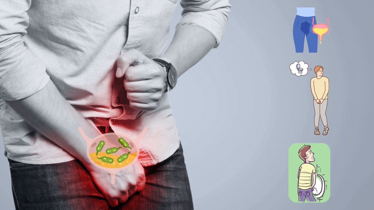 𝐁𝐥𝐚𝐝𝐝𝐞𝐫 𝐢𝐧𝐟𝐞𝐜𝐭𝐢𝐨𝐧𝐬 cause urgency, discomfort, and pain during urination. Staying hydrated and seeking antibiotics promptly can prevent complications. #BladderInfection #Urology #bladderHealth #nadeembinnusrat #urologistinpakistan #urologycliniconline