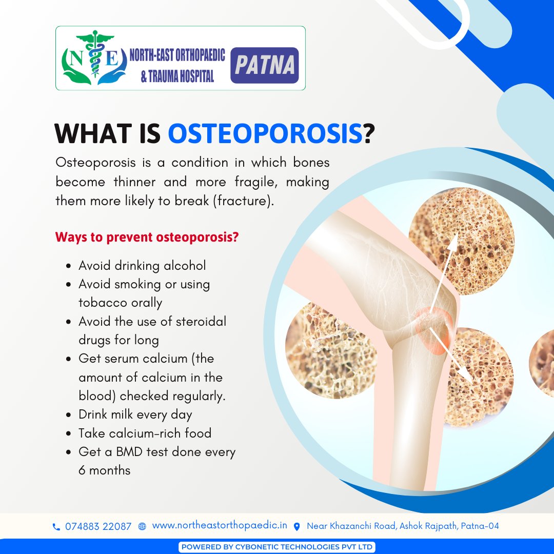 northorthopedic's tweet photo. #Osteoporosis makes bones thinner and more fragile, increasing the risk of fractures.
☎+91-74883-22087
🌐https://t.co/6TA7Mq1QI2
#BoneHealth #PreventOsteoporosis #HealthyBones #CalciumRichDiet #BMDTest #StayHealthy #StrongBones #HealthAwareness #WellnessTips #Patna #Hospital https://t.co/32f5EER12z