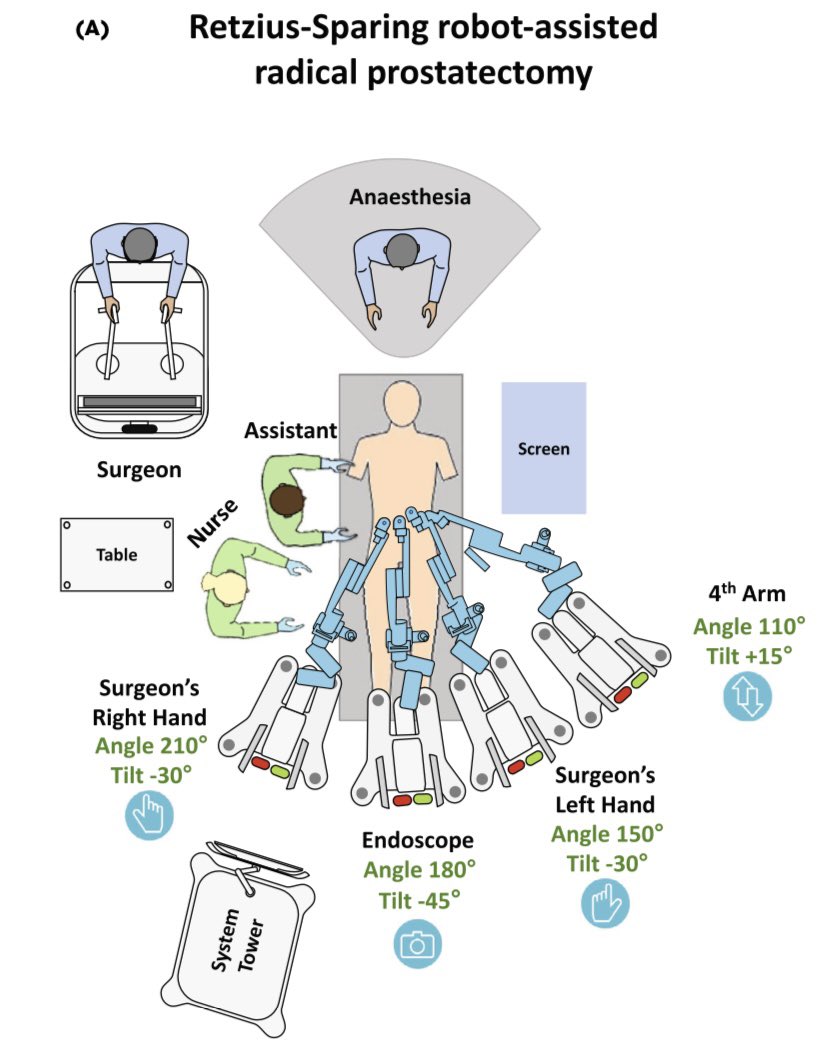 Paolo Dell'Oglio (@paolo_delloglio) on Twitter photo π£First evidence of #retzius #sparing #RARP with the novel #Hugo robotic system
<a href="/Medtronic/">Medtronic</a> <a href="/ospniguarda/">Ospedale Niguarda</a> <a href="/EAU_YAURobotics/">EAU_YAURobotics</a> <a href="/Uroweb/">European Association of Urology (EAU)</a> π£First evidence of #retzius #sparing #RARP with the novel #Hugo robotic system
<a href="/Medtronic/">Medtronic</a> <a href="/ospniguarda/">Ospedale Niguarda</a> <a href="/EAU_YAURobotics/">EAU_YAURobotics</a> <a href="/Uroweb/">European Association of Urology (EAU)</a>