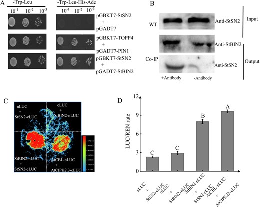 Hortres's tweet image. StSN2 maintains potato tuber dormancy by interacting with StBIN2, affecting ABA and BR signaling. #Potato #Dormancy @OxfordJournals 
Details:doi.org/10.1093/hr/uha…