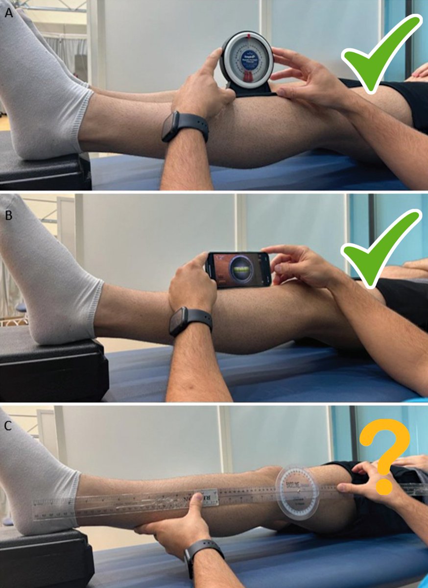 Which device to use to measure knee extension deficit after #ACL injury?

Great work Michalis Pantouveris! 👏
Link to the paper 👇
thieme-connect.com/products/ejour…