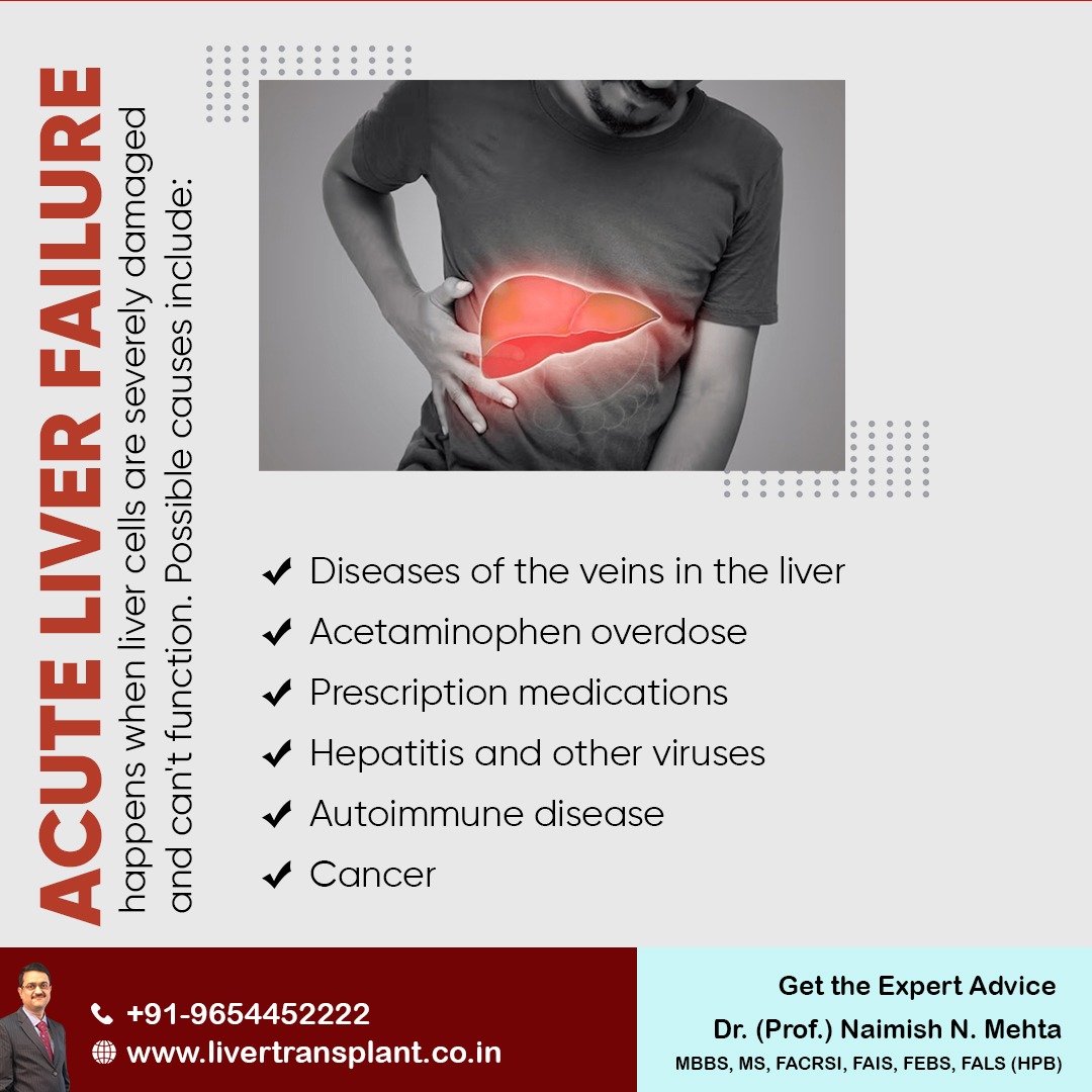 mehta_naimish's tweet image. Acute liver failure happens when liver cells are severely damaged and can&apos;t function. Possible causes include:
- Diseases of the veins in the liver
- Acetaminophen overdose
- Prescription medications

#acuteliverfailure #liverproblem #liverspecialist #liverdoctor #drnaimishmehta