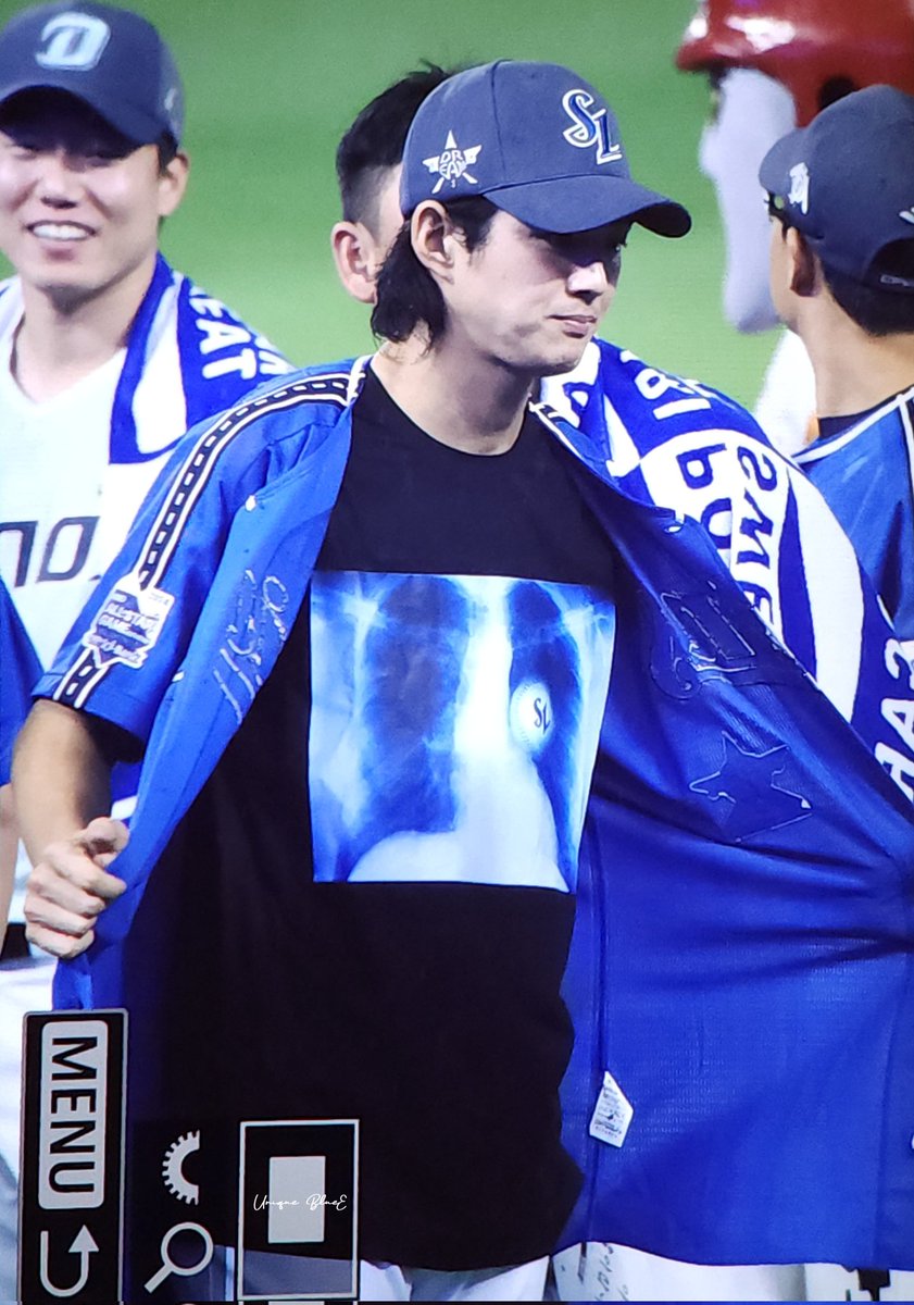 갑자기 가슴에 있는 야구공 냅다 공개하기