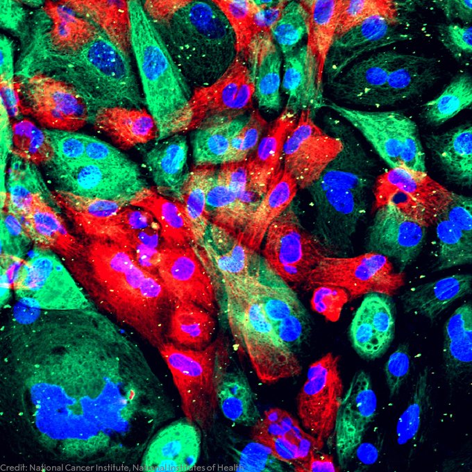 Fluorescence microscopy image of cancer cells showing various cellular structures in vibrant colors: red, green, and blue. Credit: National Cancer Institute, National Institutes of Health.