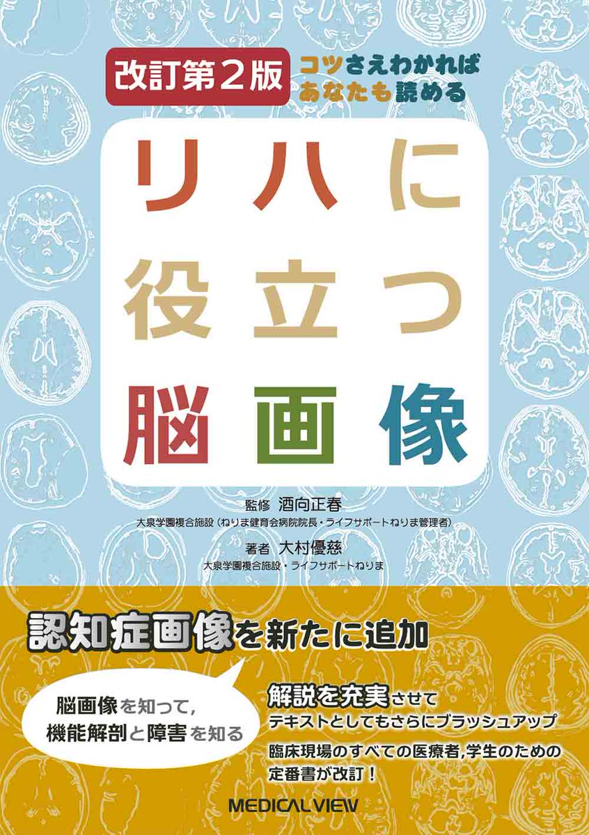 sthitori's tweet photo. コツさえわかればあなたも読める リハに役立つ脳画像 https://t.co/vy6Li49rzT
→鉄板。

リハビリPT・OT・ST・Dr.のための脳画像の新しい勉強本 https://t.co/e6mq6i7ZHz
→言語で独立した項あり。

正常画像と並べてわかる頭部MRI https://t.co/Yk5qIIxCqw
→古いですが、携帯しやすくわかりやすい。 https://t.co/2ntRwHwLZe