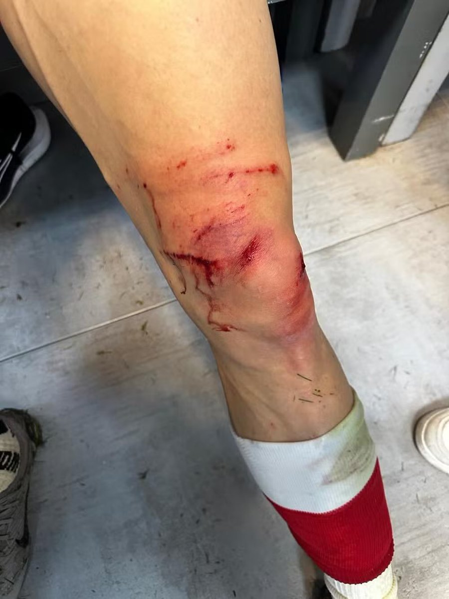 PabloGoethe's tweet image. Lloriqueos eran los de antes...