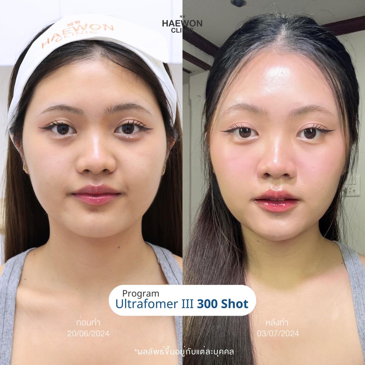 Review_Haewonclinic tweet media