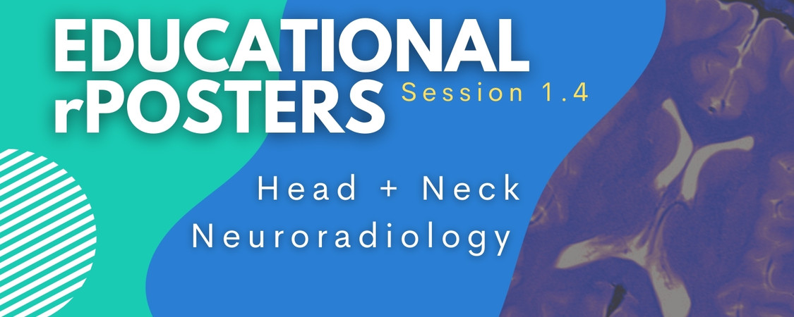 Sal Ayesa (@salayesa) on Twitter photo For all fans of #neuroradiology and #headandneckradiology, the first rPoster session is coming up in one hour at #Radiopaedia2024. Join us to find out who won the most outstanding posters and chat with the authors.
<a href="/Radiopaedia/">Radiopaedia.org</a> <a href="/murf1990/">Andrew Murphy</a> <a href="/francisdeng/">Francis Deng, MD</a> For all fans of #neuroradiology and #headandneckradiology, the first rPoster session is coming up in one hour at #Radiopaedia2024. Join us to find out who won the most outstanding posters and chat with the authors.
<a href="/Radiopaedia/">Radiopaedia.org</a> <a href="/murf1990/">Andrew Murphy</a> <a href="/francisdeng/">Francis Deng, MD</a>