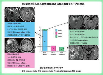 NCNP_PR's tweet photo. [プレスリリース]#NCNP病院 脳神経外科診療部と放射線診療部の研究グループは、てんかんを起こす脳腫瘍の遺伝子タイプに関連するMRI画像の特徴を発見しました。
詳細はHPをご覧ください➡https://t.co/DvaAui85Q7
#てんかん #てんかん診断 #個別化医療 #低悪性度てんかん原性腫瘍 #LEAT https://t.co/2ObGUrjyfd