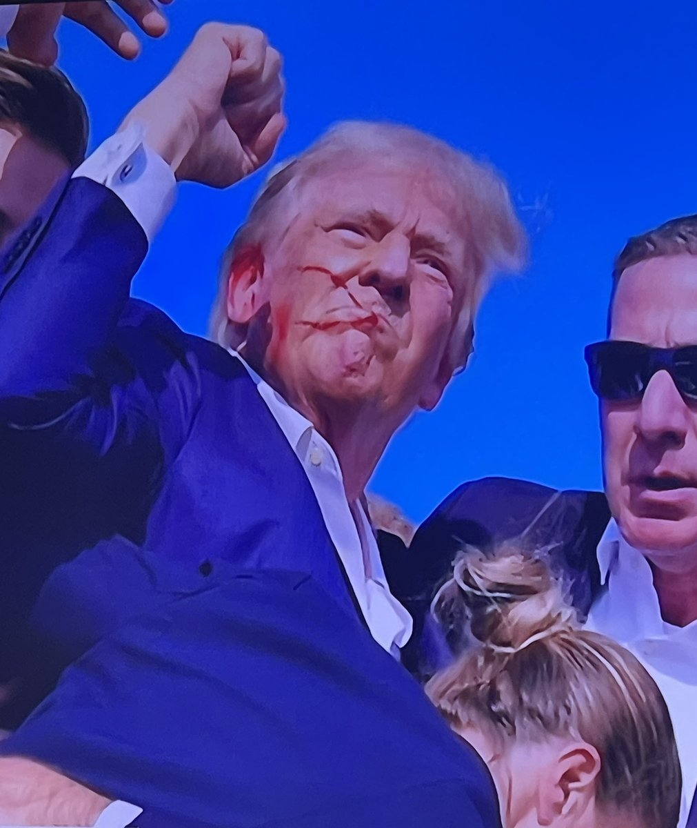 TRUMP: "My hand was covered with blood". Really?? 🤦‍♂️
#RNCConvention #Trump