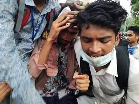 iliyaskhanu's tweet photo. In Bangladesh,students are being beaten because they are protesting for road safety...even our media is not covring this situation..plz help Bangladeshi #StudentsProtest #savebangladeshi #SaveBangladeshi_students #studentUnderAttack #Bangladesh #loveislandusa https://t.co/ODJDFE0Urv