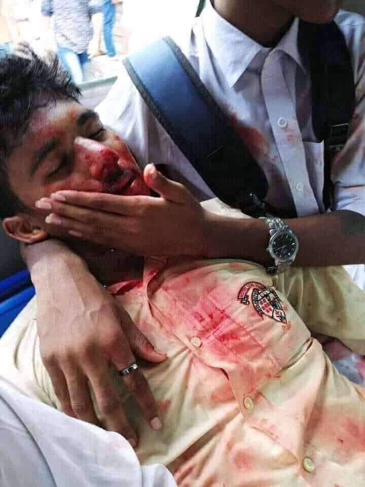 iliyaskhanu's tweet photo. In Bangladesh,students are being beaten because they are protesting for road safety...even our media is not covring this situation..plz help Bangladeshi #StudentsProtest #savebangladeshi #SaveBangladeshi_students #studentUnderAttack #Bangladesh #loveislandusa https://t.co/ODJDFE0Urv