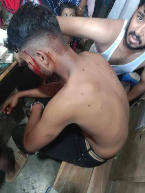 AMJihad2003's tweet photo. @meelonmuskusa Please help us. The network has been shut down for the whole day yesterday so that no one knows about these incidents. Today also 19/07/24 network off from morning please help Bangladeshi Students 
#StarLinkforBangladesh
#Bangladesh_is_out_of_control✅
#Save_Bangladeshi_students https://t.co/xX6qJHxZDq