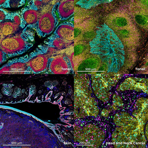 aruthak's tweet photo. @STARProtocols for high-plex, whole-slide imaging of human formalin-fixed paraffin-embedded tissue using PhenoCycler-Fusion #Spatial #HighPlex #HD https://t.co/d4WmrvWDtw

@megldono @AkoyaBio @Qld_SBC @UQ_News @WesleyResearch @TRI_info https://t.co/6Eb9mhWlOB