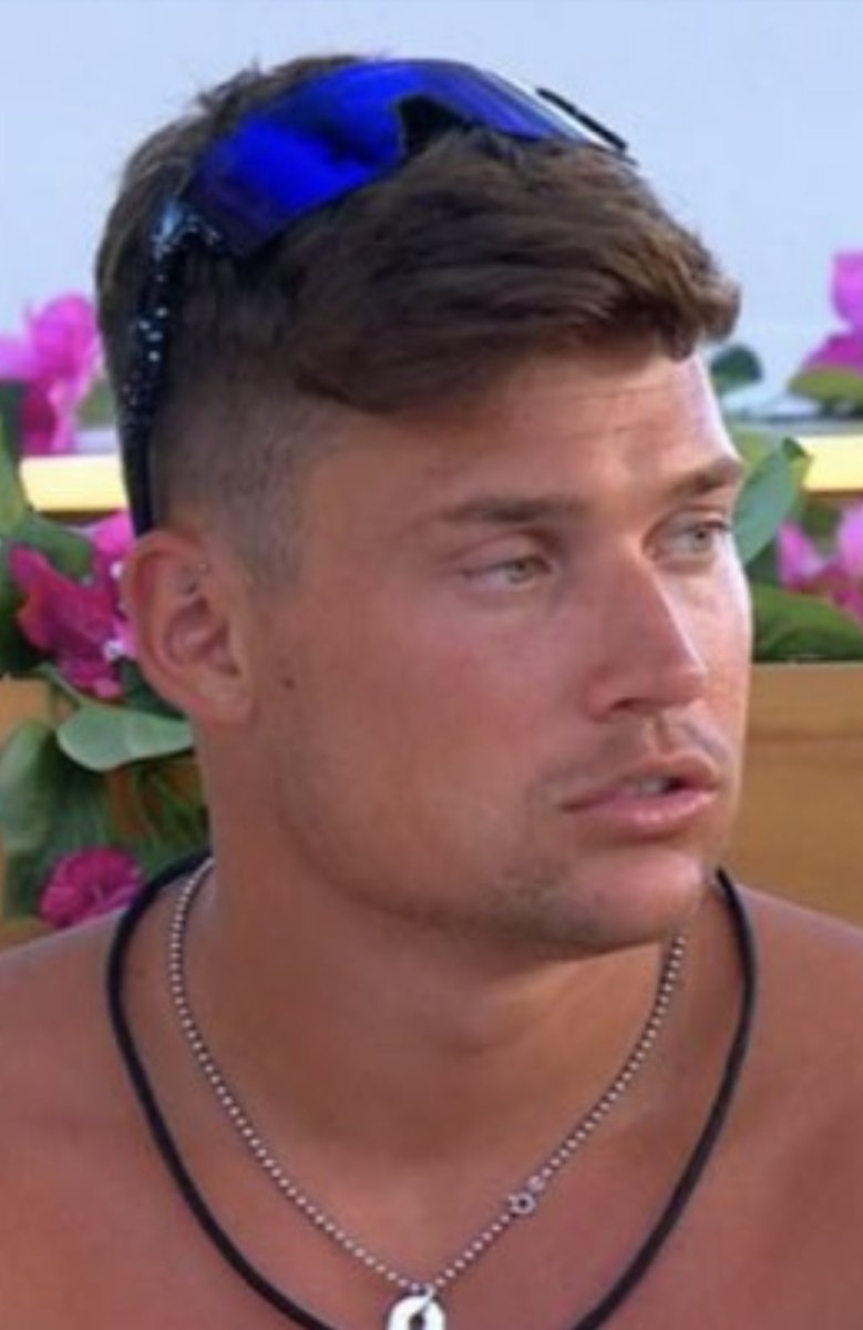 This is exactly what I looked like after I got numbed at the dentist on Monday #loveislandusa
