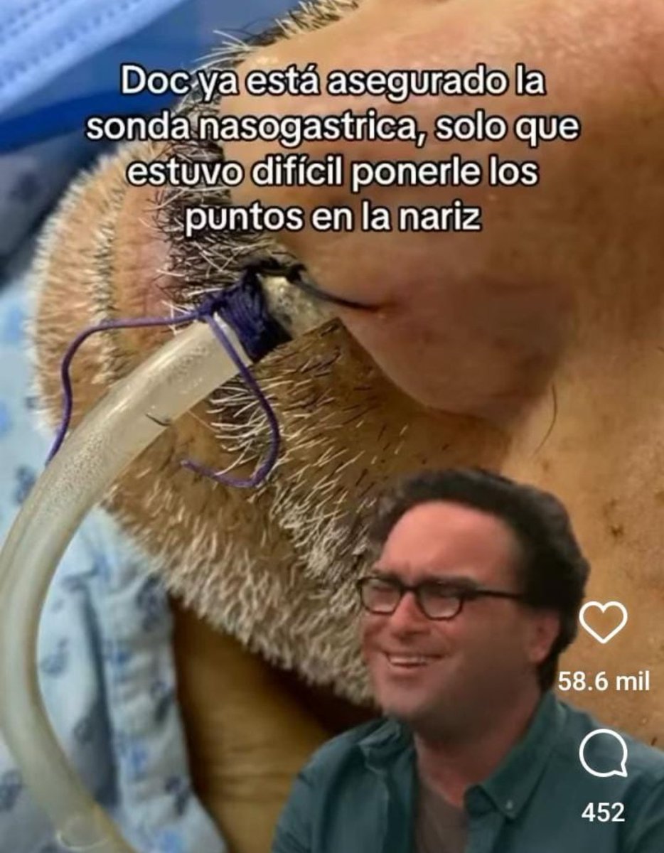 FitSurgeon's tweet photo. Hdsptm, si no es piercing https://t.co/jW4QwVyxbz