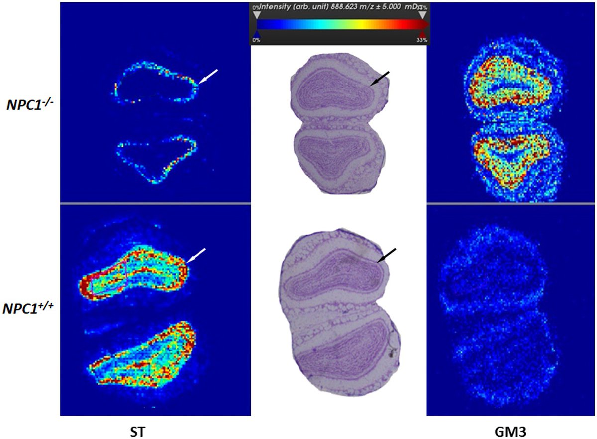 Interested in brain area increases in a Niemann-Pick disease mouse model after drug treatments?

Veronica Antipova and collaborators present their results here:
doi.org/10.3389/fnana.…

#neuroanatomy