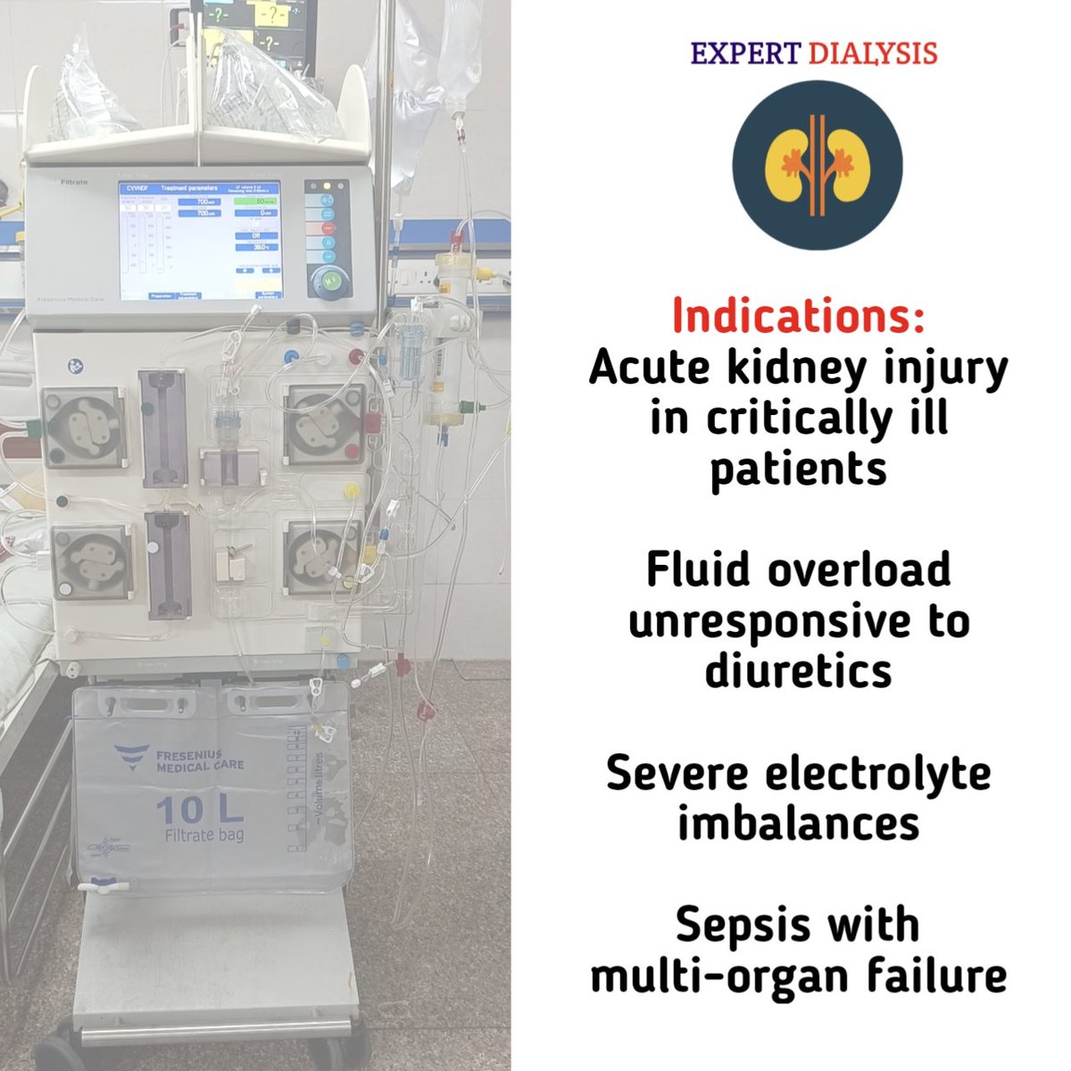 LokinderSharma9's tweet photo. 🚨Continuous Renal Replacement Therapy (CRRT) is a lifesaving treatment for critically ill patients with kidney failure. It offers gentle, 24/7 dialysis support. #CRRT #KidneyHealth #ICU #Nephrology #CriticalCare #Pgimer #Dialysis https://t.co/3fCcG1Zt2x