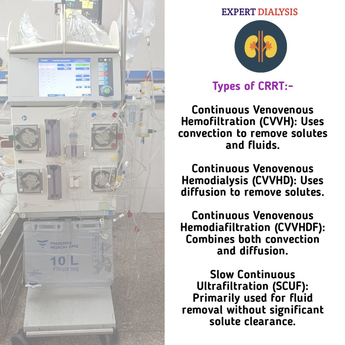LokinderSharma9's tweet photo. 🚨Continuous Renal Replacement Therapy (CRRT) is a lifesaving treatment for critically ill patients with kidney failure. It offers gentle, 24/7 dialysis support. #CRRT #KidneyHealth #ICU #Nephrology #CriticalCare #Pgimer #Dialysis https://t.co/3fCcG1Zt2x