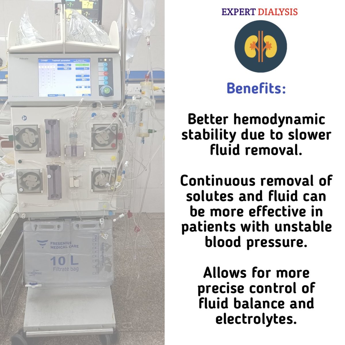 🚨Continuous Renal Replacement Therapy (CRRT) is a lifesaving treatment for critically ill patients with kidney failure. It offers gentle, 24/7 dialysis support. #CRRT #KidneyHealth #ICU #Nephrology #CriticalCare #Pgimer #Dialysis