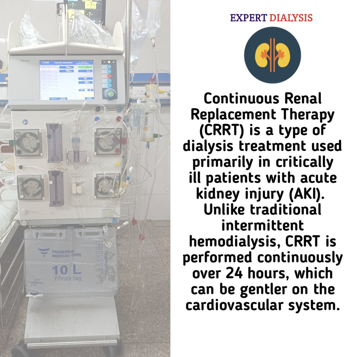 LokinderSharma9's tweet photo. 🚨Continuous Renal Replacement Therapy (CRRT) is a lifesaving treatment for critically ill patients with kidney failure. It offers gentle, 24/7 dialysis support. #CRRT #KidneyHealth #ICU #Nephrology #CriticalCare #Pgimer #Dialysis https://t.co/3fCcG1Zt2x