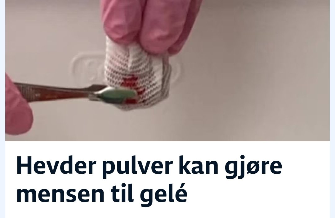 Barnebursdager blir aldri det samme igjen