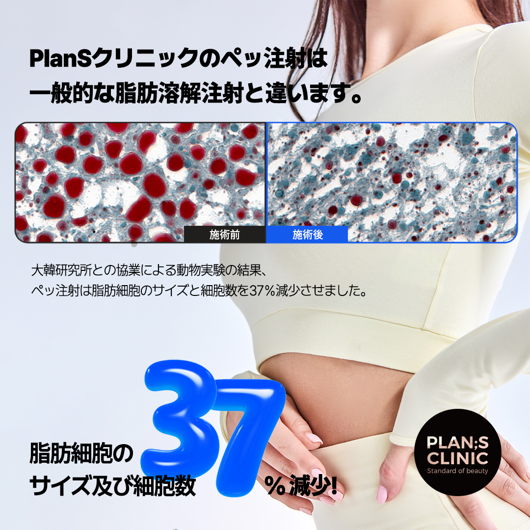 プランエス　脂肪 sddefault.jpg