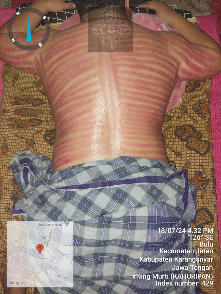 NingMurti2's tweet photo. 087735582728
PIJAT CAPEK, KERIK / PIJAT &amp; KERIK.  Bulu, Jaten Karanganyar Rt/w 01/03. REAL PIJAT..!! NO PLUS"...!!!. Terima PRIA dan WANITA. Terapis Wanita, Saya sendiri (Ning Murti) https://t.co/MXgtvEPhY0