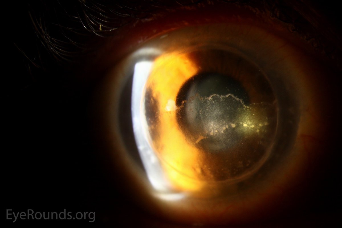 Dr Gunjan Deshpande MRCSEd, FICO (UK), FAICO, DNB tweet media