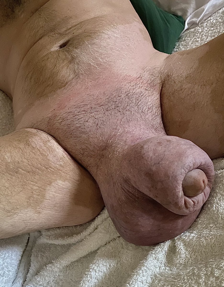 SpottedMonster tweet media