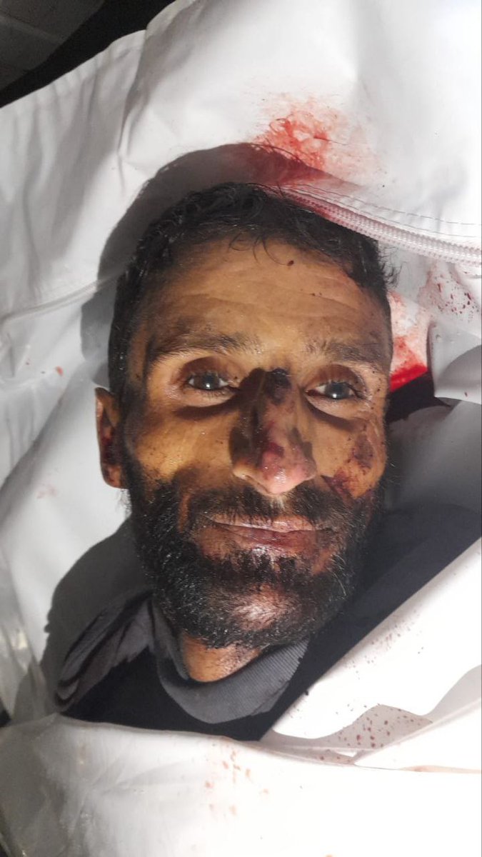 Şehadet bir çağrıdır, tüm çağlara..
Rabbim şehadetini kabul etsin inşallah.
📌 Gazze