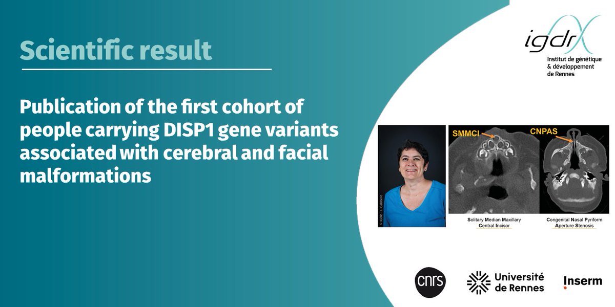IGDR (@igdrennes) on Twitter photo 📢 #ScientificResult 🔎| Discover the latest publication from <a href="/ValerieDupe/">Dupe Research group</a> <a href="/InsermGrdOuest/">Inserm Grand Ouest</a> leader team at <a href="/IGDRennes/">IGDR</a> with her collaborators
🤝 <a href="/CNRS_dr17/">CNRS Bretagne et Pays de la Loire</a> <a href="/CNRSbiologie/">CNRS Biologie</a> <a href="/RennesUniv/">Université de Rennes</a>
📕<a href="/GIMJournal/">Genetics in Medicine</a> | igdr.univ-rennes.fr/en/publication… 📢 #ScientificResult 🔎| Discover the latest publication from <a href="/ValerieDupe/">Dupe Research group</a> <a href="/InsermGrdOuest/">Inserm Grand Ouest</a> leader team at <a href="/IGDRennes/">IGDR</a> with her collaborators
🤝 <a href="/CNRS_dr17/">CNRS Bretagne et Pays de la Loire</a> <a href="/CNRSbiologie/">CNRS Biologie</a> <a href="/RennesUniv/">Université de Rennes</a>
📕<a href="/GIMJournal/">Genetics in Medicine</a> | igdr.univ-rennes.fr/en/publication…