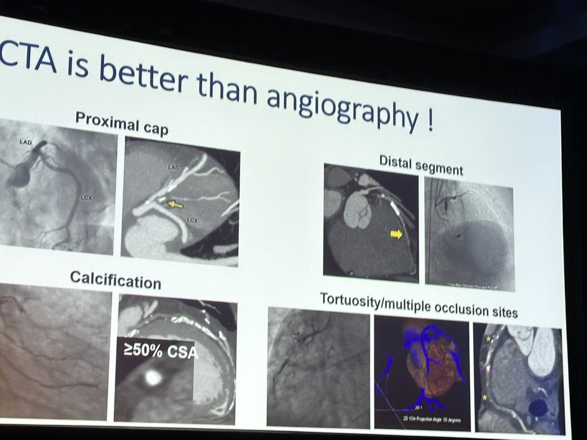 Bruno Lima (@brunolimamdphd) on Twitter photo 🚀 Key points from <a href="/ColletCarlos/">Carlos Collet MD PhD</a>' talk at #SCCT2024 on #YesCCT for PCI planning:
1️⃣ Coronary CT characterizes CAD for PCI planning.
2️⃣ P4 approach integrates CT-based PCI planning.
3️⃣ CT-guided PCI could become the standard of care.
#YesCCT <a href="/Heart_SCCT/">Heart_SCCT</a> 🚀 Key points from <a href="/ColletCarlos/">Carlos Collet MD PhD</a>' talk at #SCCT2024 on #YesCCT for PCI planning:
1️⃣ Coronary CT characterizes CAD for PCI planning.
2️⃣ P4 approach integrates CT-based PCI planning.
3️⃣ CT-guided PCI could become the standard of care.
#YesCCT <a href="/Heart_SCCT/">Heart_SCCT</a>