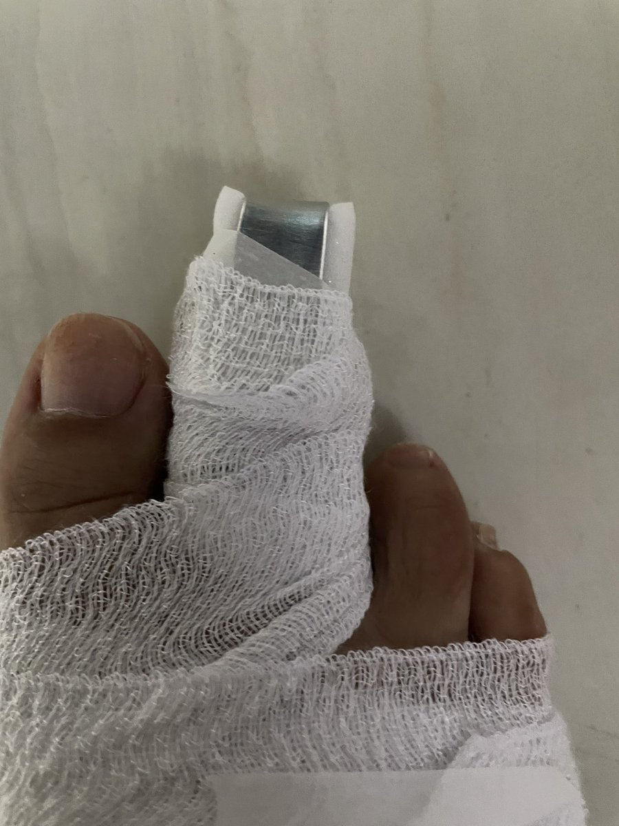 BkekBm's tweet photo. 人生初骨折😿
しばらくは運動禁止で安静必要だって😓

もう色々踏んだり蹴ったりだな😭 https://t.co/JAVN4fbMuJ