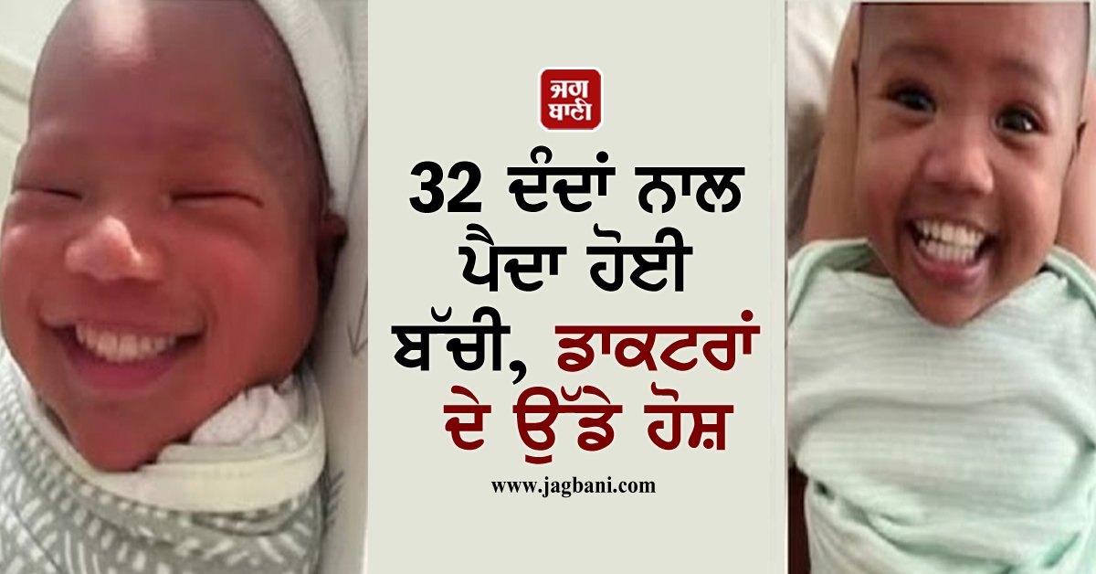 JagbaniOnline's tweet photo. 32 ਦੰਦਾਂ ਨਾਲ ਪੈਦਾ ਹੋਈ ਬੱਚੀ, ਡਾਕਟਰਾਂ ਦੇ ਉੱਡੇ ਹੋਸ਼
https://t.co/pLyxcAoFMo
#NewlyBornBaby #32Teeth #DoctorSuprised #Jagbani https://t.co/tmsetf45JO