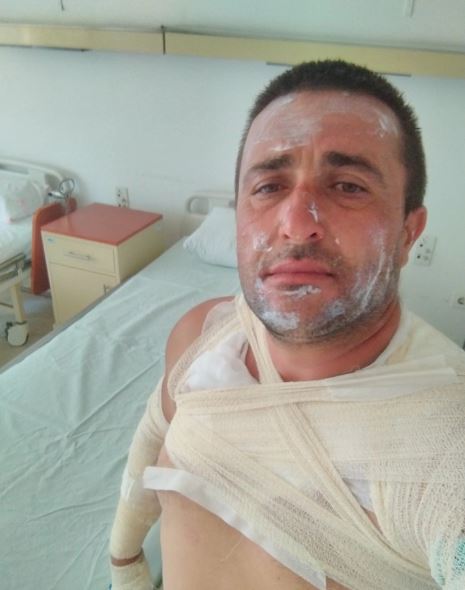 Ова е Златко Димов, повредениот од пожарот кај с.Сирково при неговото гаснење.
Златко е сопруг и татко на три малолетни деца и невработен.
Со својот трактор правел противпожарен појас за да огнот не дојде до селото.
Ветрот го сменил правецот и се нашол во среде оган.