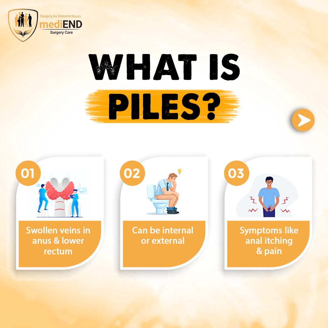 medi_end_'s tweet photo. WHAT IS PILES...
Visit our website for more info: https://t.co/LTKcmoIdjS
.
.
.
.
#Health #healthcare #mediendsurgery #surgery #exerciseregularly #StayHydrated #sclerotherapy #pilessymptoms #rubberbandligation #PilesRelief #PilesSurgery #medicines #staplerhaemorrhoidectomy https://t.co/6GplbGzvvt