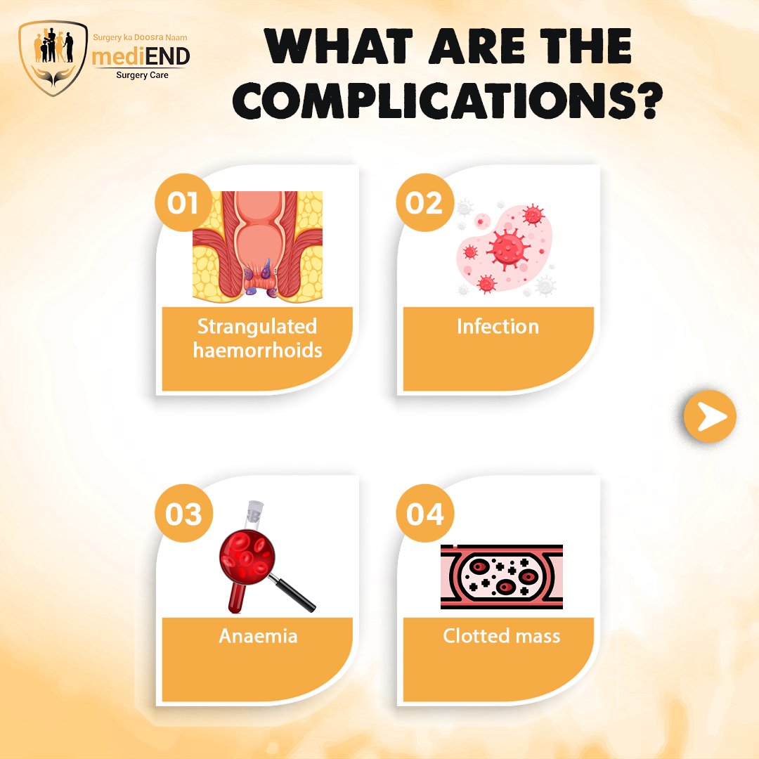 medi_end_'s tweet photo. WHAT IS PILES...
Visit our website for more info: https://t.co/LTKcmoIdjS
.
.
.
.
#Health #healthcare #mediendsurgery #surgery #exerciseregularly #StayHydrated #sclerotherapy #pilessymptoms #rubberbandligation #PilesRelief #PilesSurgery #medicines #staplerhaemorrhoidectomy https://t.co/6GplbGzvvt