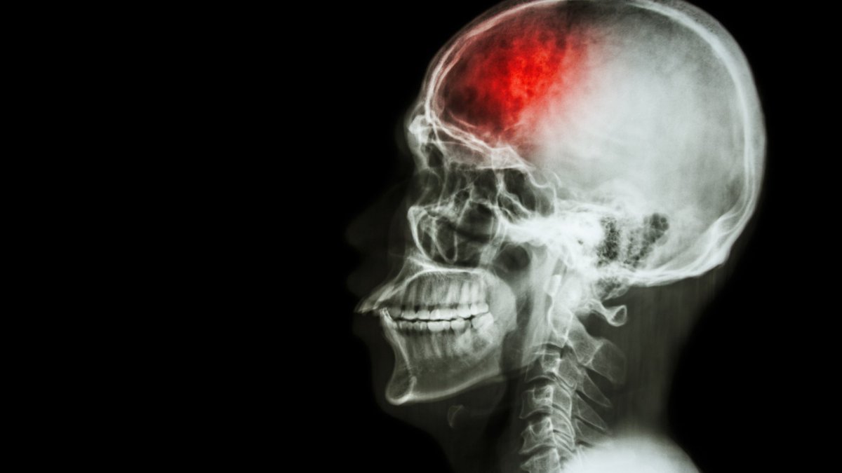 Brain Inflammation Collaborative tweet media