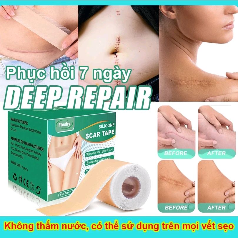 trangphap27's tweet photo. Xem ngay miếng dán che sẹo miếng dán sẹo lồi 4cm x 150cm sẹo lồi sẹo lõm sẹo thâm tiệp màu da miếng dán sẹo với giá ₫90.000 - ₫429.000. Mua ngay trên Shopee! https://t.co/17EbaZ8lFG https://t.co/4h1X2onnhJ