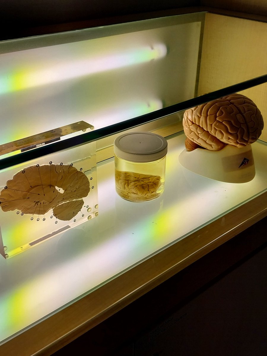dilutedhcl's tweet photo. 🧠 https://t.co/f4HfuqvRBP