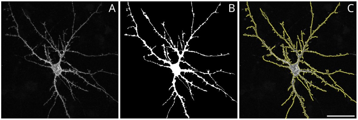 NikonInst's tweet photo. A recent preprint describes a protocol-type workflow for #LiveCell #Fluorescence #Microscopy of cells immobilized in agarose, better recapitulating their natural environment, as well as analysis – click to check it out: https://t.co/lpUWywNj3r https://t.co/NypWVFETMA