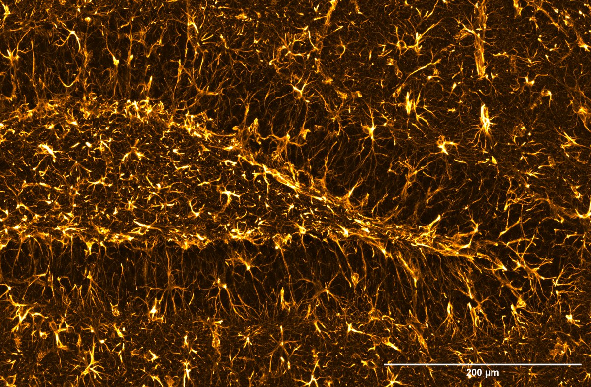 toby_segasby's tweet photo. GFAP across the hippocampus, from region down to cell. 

Cant stop driving around this image and zooming in on all the different astrocytes.

#FluorescenceFriday #Neuroscience #Hippocampus #Astrocytes #Microscopy #Leica #Science #sciart #imaging #GFAP

@RCSI_Irl @DCU_LSI https://t.co/0O9rEpXrAD