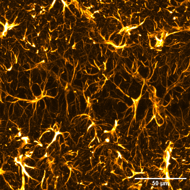 toby_segasby's tweet photo. GFAP across the hippocampus, from region down to cell. 

Cant stop driving around this image and zooming in on all the different astrocytes.

#FluorescenceFriday #Neuroscience #Hippocampus #Astrocytes #Microscopy #Leica #Science #sciart #imaging #GFAP

@RCSI_Irl @DCU_LSI https://t.co/0O9rEpXrAD