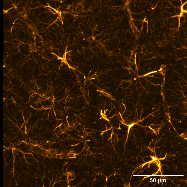 toby_segasby's tweet photo. GFAP across the hippocampus, from region down to cell. 

Cant stop driving around this image and zooming in on all the different astrocytes.

#FluorescenceFriday #Neuroscience #Hippocampus #Astrocytes #Microscopy #Leica #Science #sciart #imaging #GFAP

@RCSI_Irl @DCU_LSI https://t.co/0O9rEpXrAD