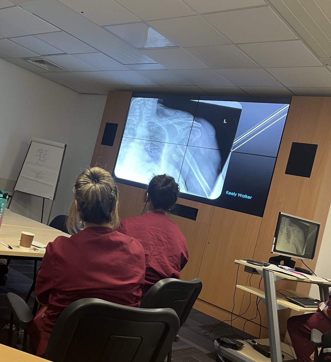 rwt_apprentices's tweet photo. I spent a few hours with our Diagnostic Radiography apprentices this morning at @RWT_NHS for their group CPD session.
I saw some fab presentations on #lumbarspine #scaphoids #shoulder & #humerus
Well done & thank you for having me - Danielle π©»π¦΄β’οΈ
#apprenticeship #CPD #NHS https://t.co/bm3YOwusJS