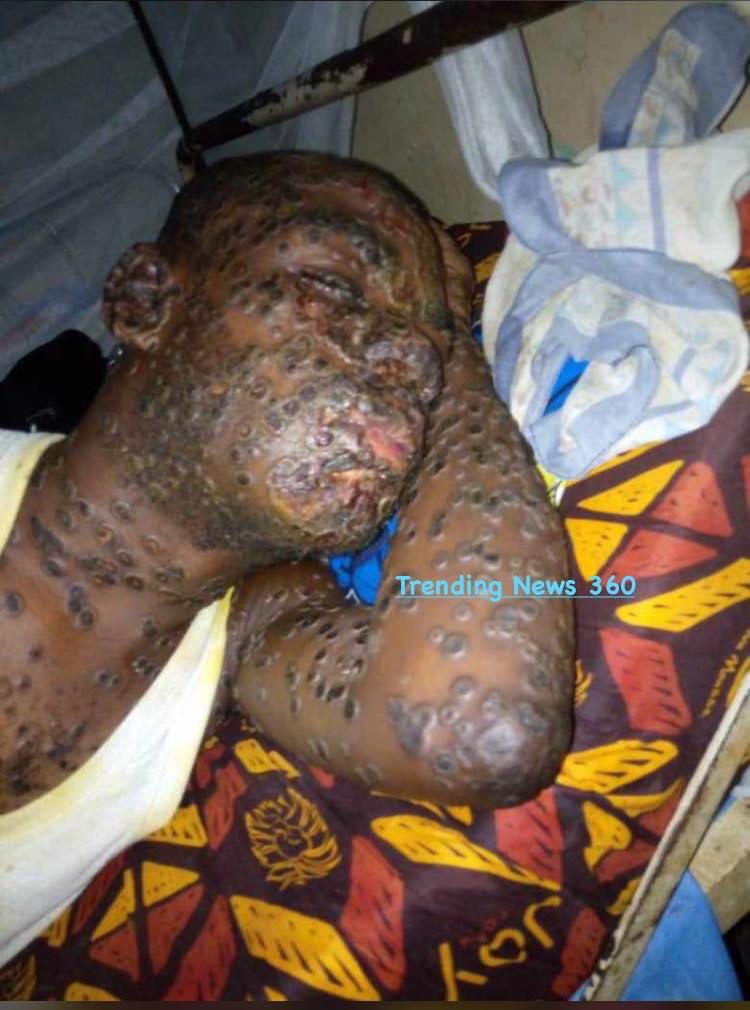 trendingnew360's tweet photo. Dengue fever

Dengue fever is a mosquito-borne viral illness that affects millions of people worldwide, especially in tropical and subtropical regions.

#TrendingNews360 https://t.co/kPPMv2qxRS