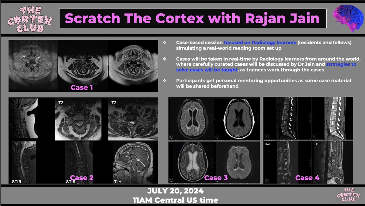 PublishedXPrime's tweet photo. History and limited images have been given to our participants. All images and more information will be revealed at the session! 

If you think you know what these cases are or want to know, join us tomorrow July 20 at 11AM central U.S. time! 

Register here: https://t.co/e5HDXUWaSE

@CoolAsANeuroRad @thecortexclub @RamVaidhyanath @pranj_rad @MarcusKonner @brijmohanpandya @kebronatnaw